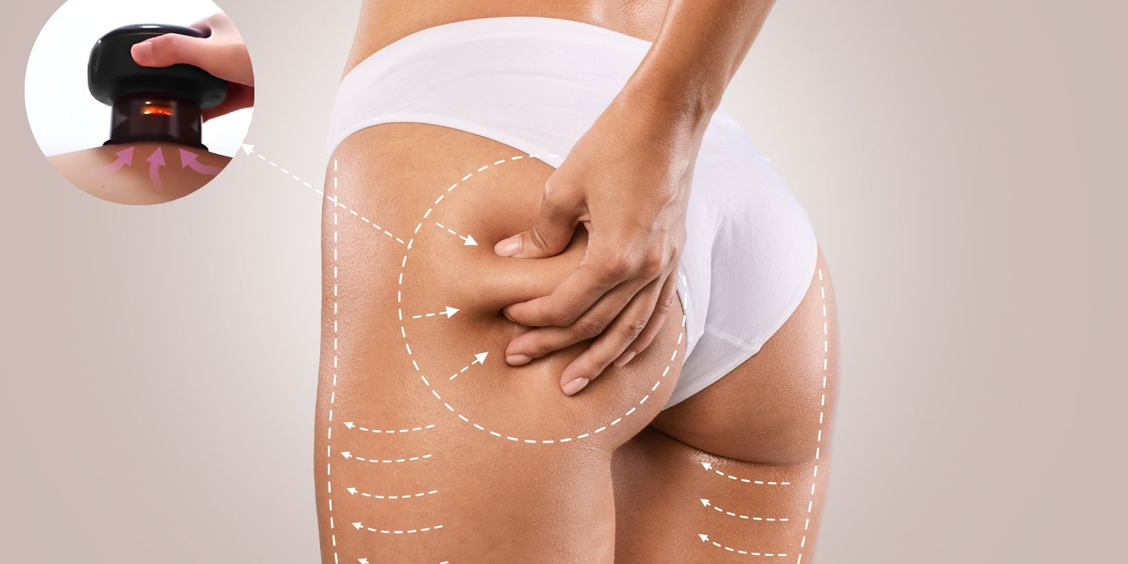 une photo qui montre un corps d'une femme avec la ventouse anti cellulite, cette photo accompagne l'article Comment utiliser la ventouse à cellulite ?