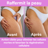 une image qui contient deux images de l'avant et l'après d'utilisation de kit pour éliminer la cellulite